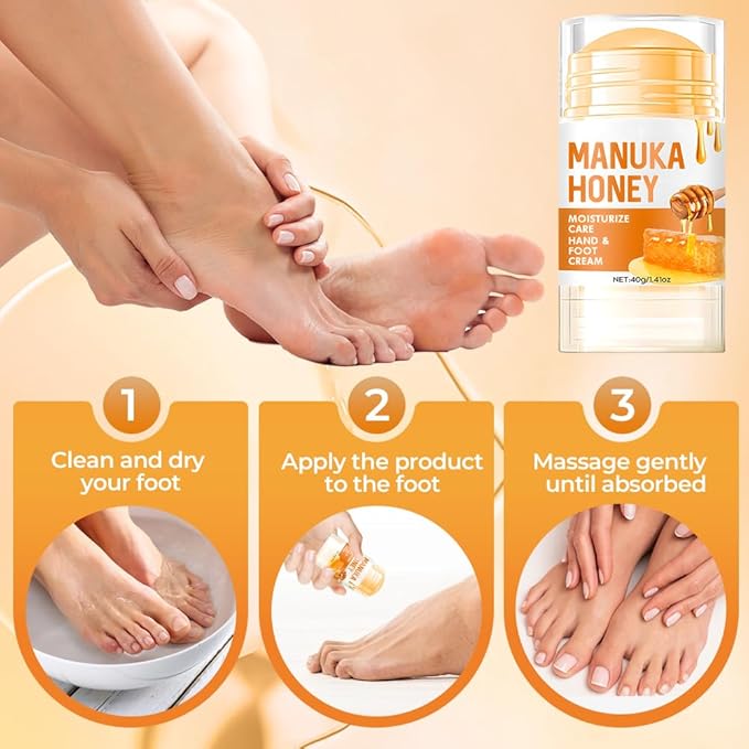 60% Urea Hydrating and Anti-Cracking Foot Cream, Moisturising and Relieves Cracking and Dryness Foot Cream for Cracked Heels,Hands,Knees,Exfoliating Moisturizer (Yellow, one size)