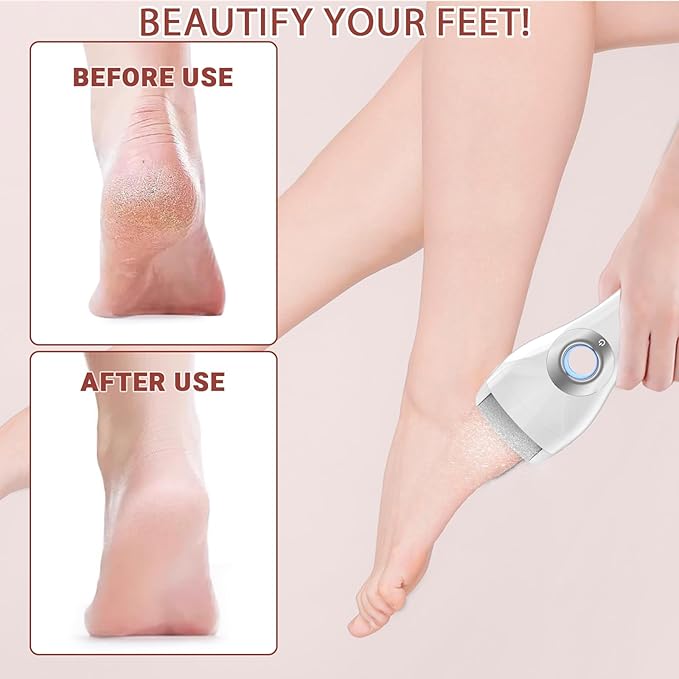 Upgraded Rechargeable Foot Callus Remover, Professional Electric Foot File, 10 in 1 Pedicure Tools Foot Care Kit Pedi Feet Care for Dead, Hard Cracked Dry Skin Ideal Gift (White)