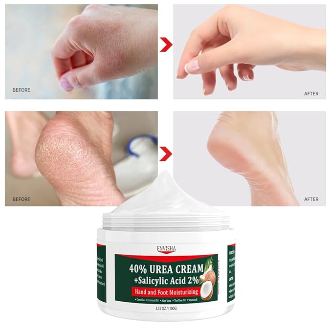 ENVISHA 40% Urea Cream for Dry Cracked Feet- Maximum Strength Foot & Hand Moisturizer with 2% Salicylic Acid, Tea Tree, and Aloe Vera | Deep Hydration & Softener for Feet Care