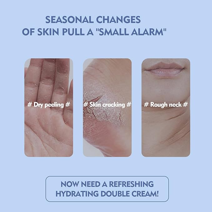 Vovo Angel Winter Foot Care Cream with Aloe Vera & Urea – Deep Moisturizing Heel Repair Balm for Dry, Cracked Feet, Softening & Nourishing Foot Moisturizer, 40g (Aloe Vera + Urea, 40g)