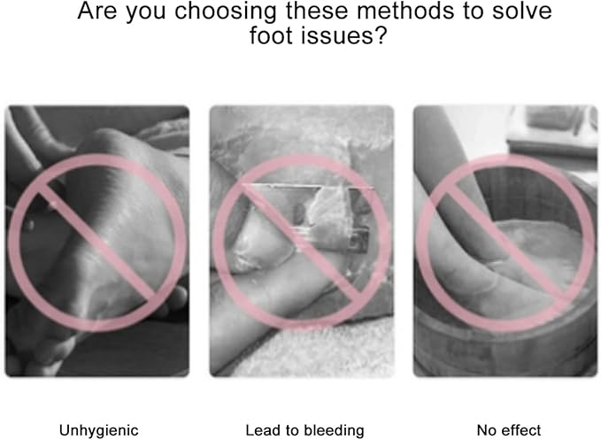 Electric Foot Callus Remover, Electric Foot File with 60pcs Sharpener, Electric Foot Filter for Remove Chapped Dry Dead Skin and Calluses on The Heel (US Plug 100-240V)