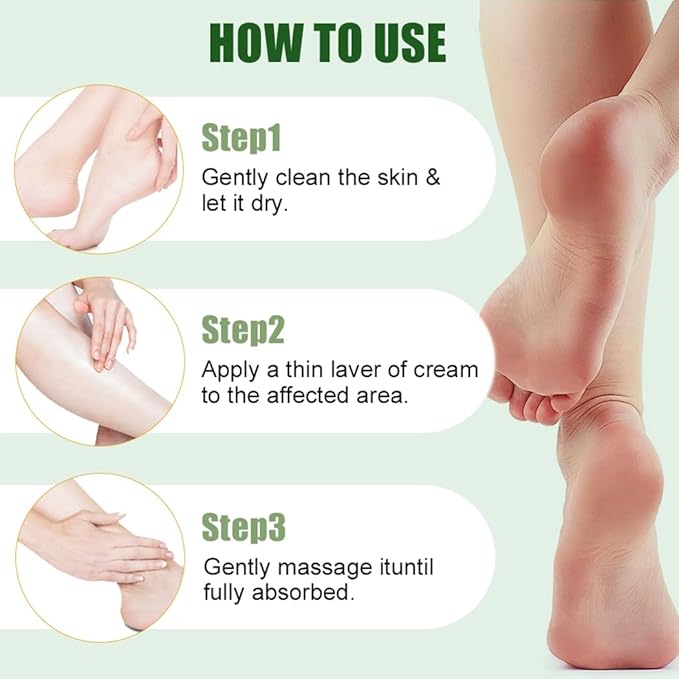 Urea Cream 60% plus 2% Salicylic Acid for Feet – Maximum Strength Foot Cream For Dry, Cracked Heels and Calluses. Deeply Exfoliates Dead skin & Moisturizes, Repairs Rough Feet – 6.35 oz