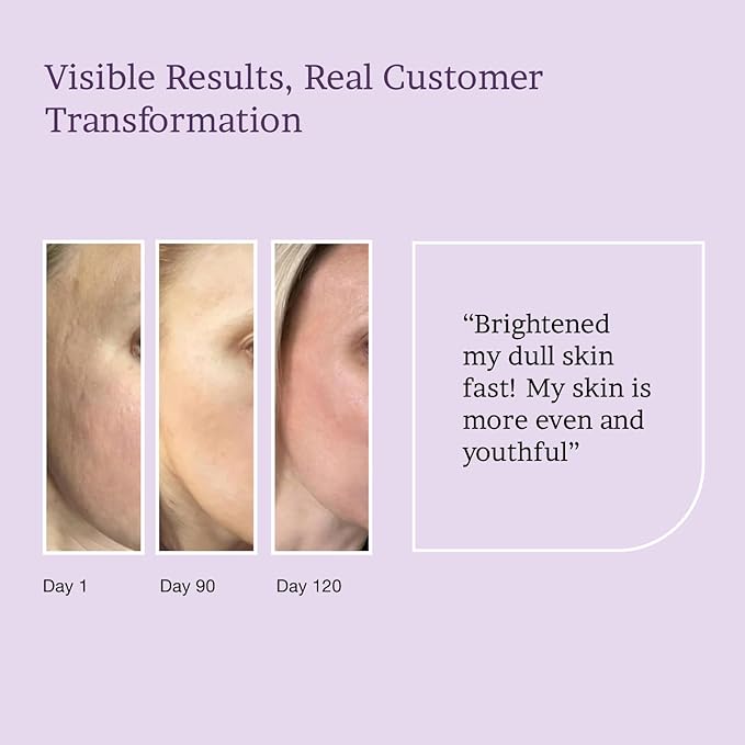 MAXDAHLIA Petal Peel - 20% AHA Serum | Mandelic & Lactic Acid | Resurfacing & Renewing Overnight Treatment for Dark Spots, Uneven Skin Tone & Acne Scar Remover