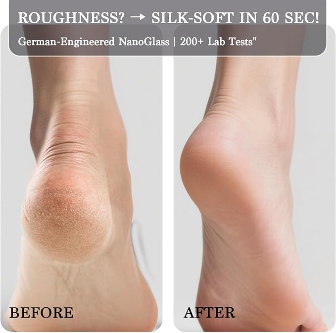 Hard Skin Remover Nano Glass Foot File with Non-Slip Ergonomic Handle, Professional Veinsgrain Foot Care Pedicure Tools for Smooth Feet (Blue)