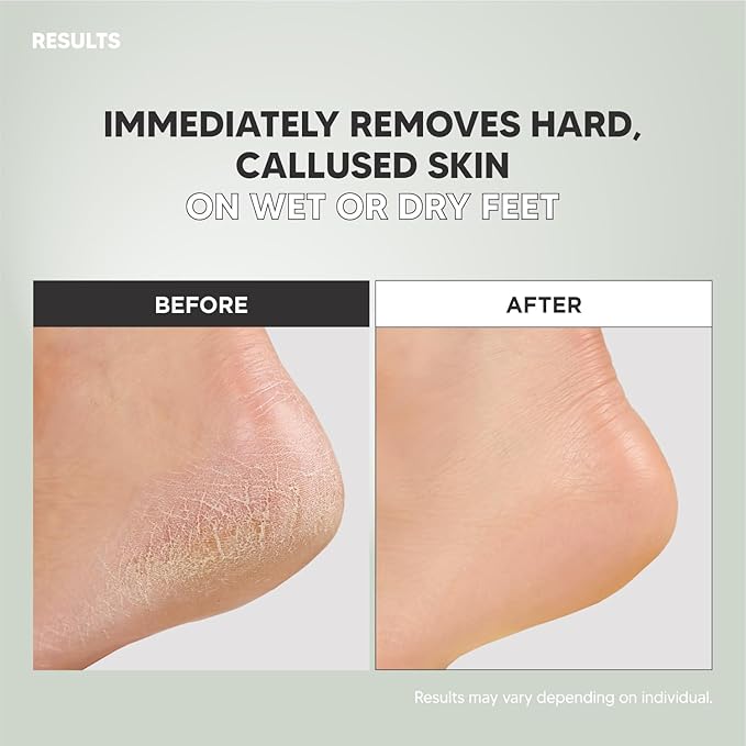 S-Line Emery Foot File, Colossal Double-Sided Pedicure Tool, Effective for Cracked Heel, Ergonomic Design for Easy Grip (Purple Heart)