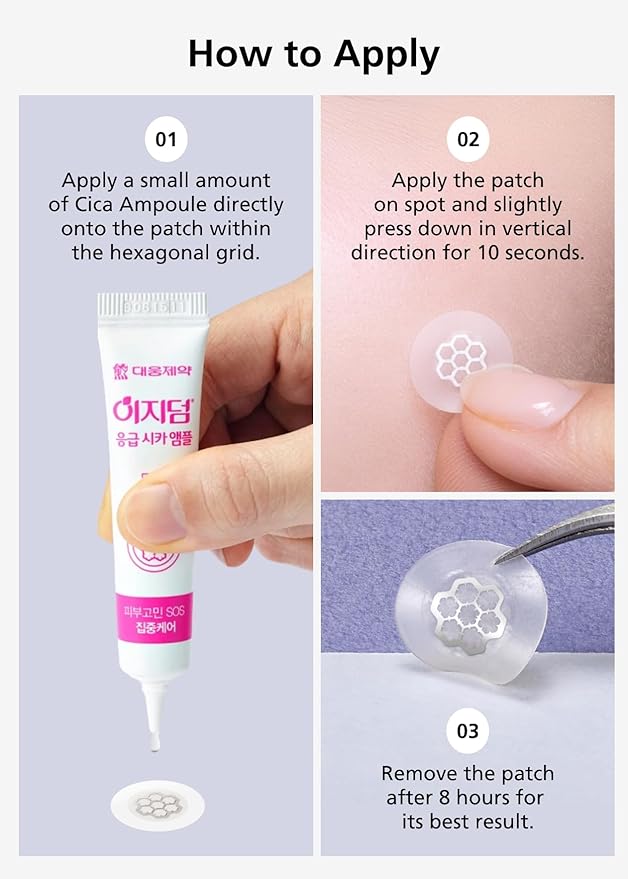 EasyDerm Quick Calming Magnesium Patches – Hydrocolloid Acne Spot Treatment Includes Tweezers & Ampoule, 10 Patches, Zit Sticker, Made by Daewoong Pharmaceutical