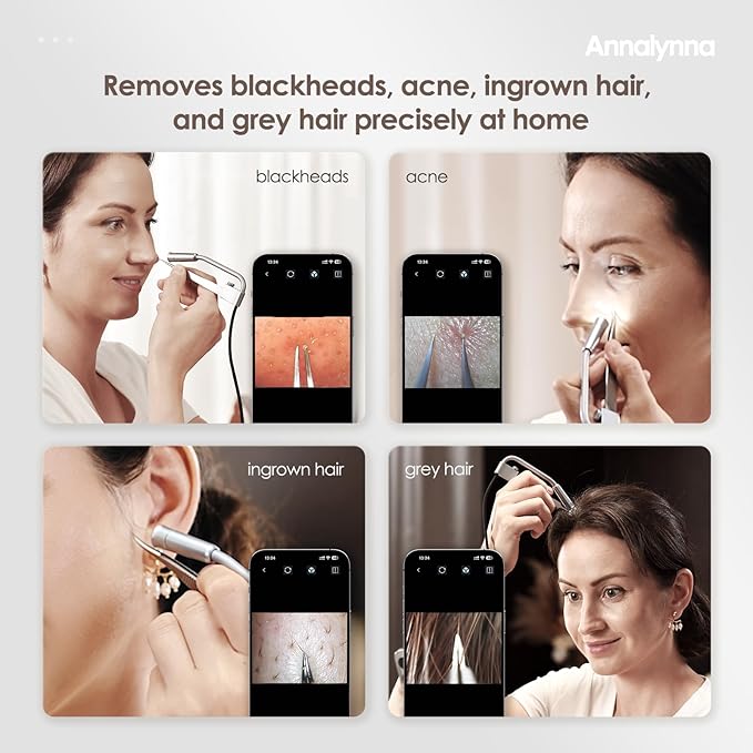 Luma 1 Visual Blackhead Remover Tweezers with Camera - Pimple Popper Tool with Camera 20x Magnification, 1080P, 8 LED Lights, with Blackhead Remover Pimple Popper Tool Kit (6 Piece Kit)