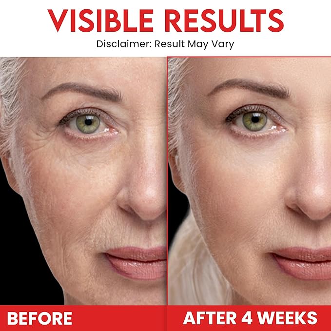 Whipped Tallow Honey Balm – Grass-Fed Beef Tallow infused with Manuka Honey, Rosehip, Jojoba & Almond Oils – No Essential Oils, Nourishing Face, Neck & Body Lotion, 100% Organic (Unscented - 2 oz)