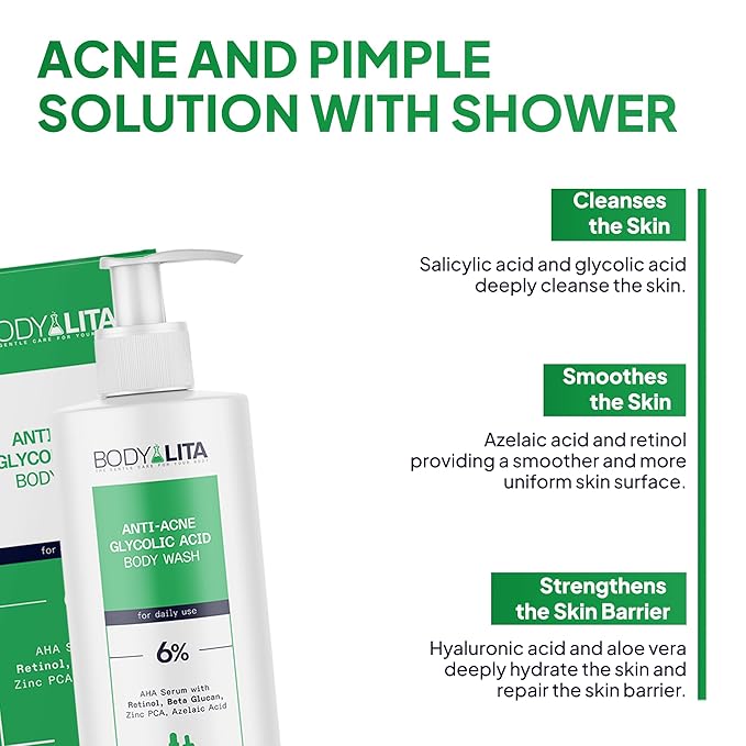 Anti Acne Glycolic Acid Body Wash for Acne Prone Skin, Helps Improve Skin Texture with Salicylic and Azelaic Acid, 5.07 Fl Oz (1)