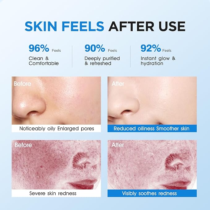 Baby Go Dewy STRING FOAM Barrier Friendly Non-Drying Facial Cleanser with APG & Plant-Powered Ingredients, Foaming Facial Cleanser Fragrance Free Sensitive Skin Friendly