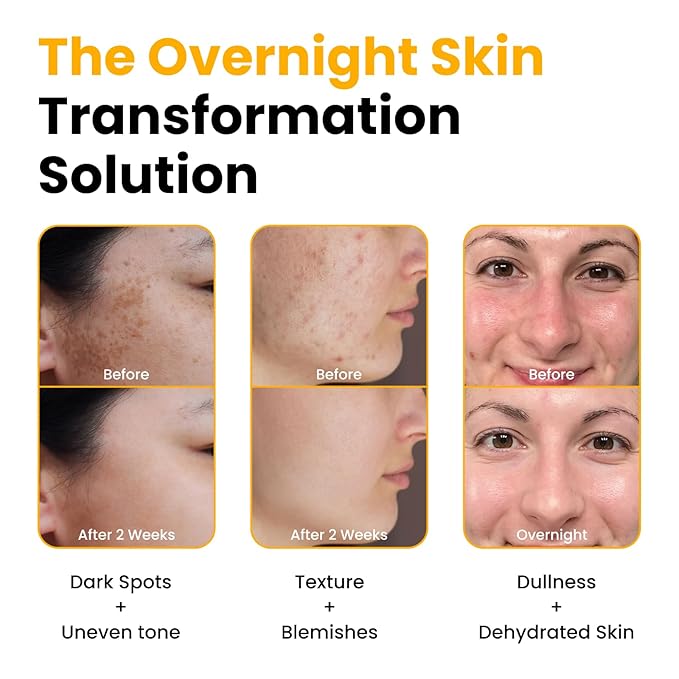 QUIA Collagen Jelly Cream + Turmeric Overnight Wrapping Mask – Daily Hydration and Night Repair Skincare Set – Korean Skincare Moisturizer + Sleeping Mask