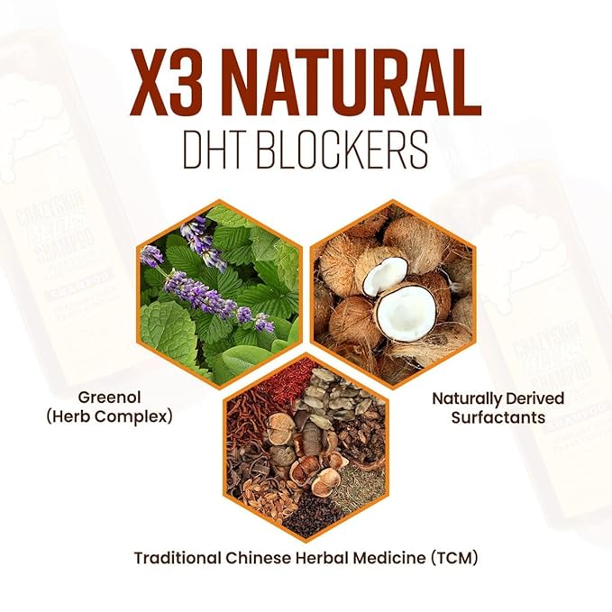 CRAZY SKIN German Beers Yeast Biotin Shampoo for Hard water, Anti-hair loss, and Thickening,Gentle Exfoliating & Scalp Function with Panthenol, Collagen and Free-Sulfate, Chemical, 300ml(10.15oz)