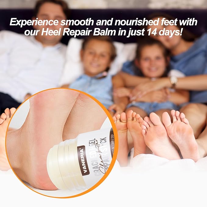 Shea Butter Dry Cracked Hands and Feet Repair Stick, Moisturizing Foot Cream with Shea Butter and Coconut Oil，Moisturizes and Softens Heels, Gently Exfoliates and Improves Dry Skin，1.41 OZ