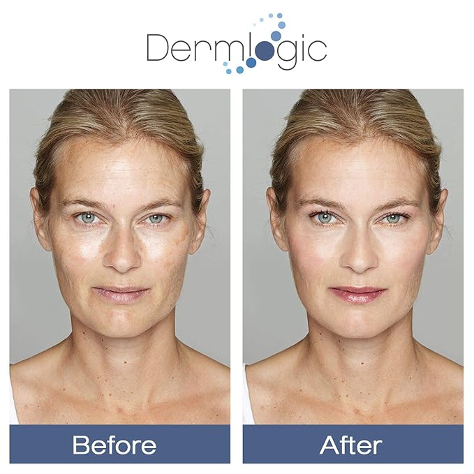 Glycolic Cream 15% - Natural Anti Aging Exfoliator to Smooth Away Fine Lines & Wrinkles & Improve a Dull Looking Complexion. Includes A.H.A & Green Tea Moisturizer for Face & Body.