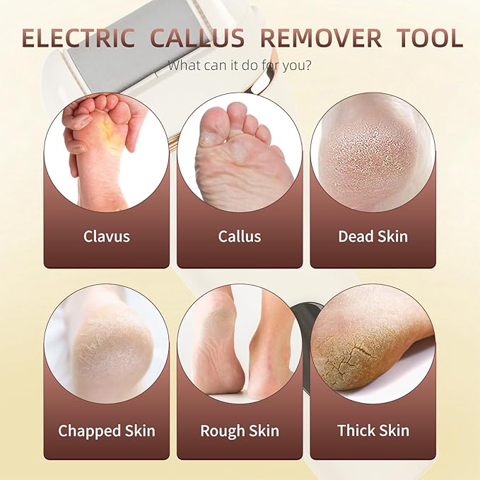 Electric Foot Scrubber File Callus Remover with Socks, Electric Callus Foot Grinder Feet Spa Care Kit for Dead Dry Skin 3 Rollers, 2 Speed, Battery Display