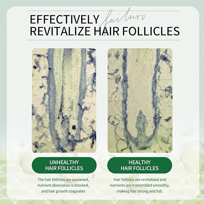 Aero Zen Batana Hair Growth Oil, 100% Pure Natural Batana Oil, Unrefined, Repairs Damaged, Dry Hair and Split Ends, Enhances Hair Volume, Suitable for Both Men and Women (3.78 oz)