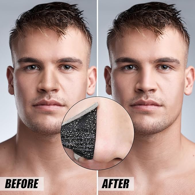 80 Pcs Blackhead Remover Pore Strips, Black Head Remover for Face, Natural Charcoal Nose Strips for Pore Cleaner, Large Size Nose Pore Strip for Men Women for Oil Blackheads & Whiteheads Remover