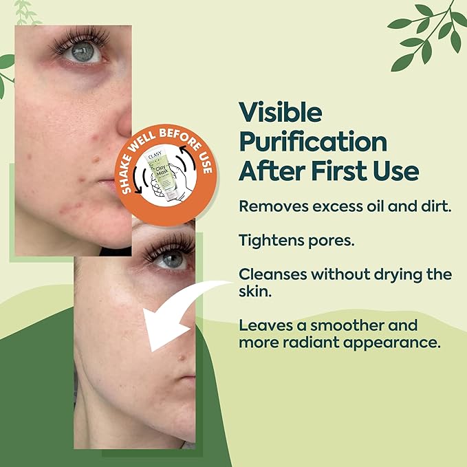 Clay Mask for Face – Pore Firming & Deep Cleansing Face Mask | Anti-Blackhead | Oil Balancing | Moisturising & Natural Ingredients, 100ml