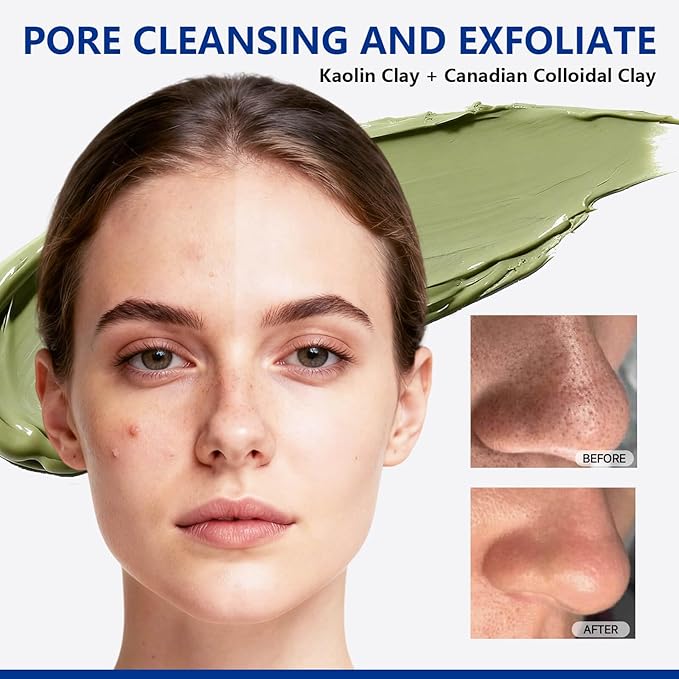 Deep Cleansing Green Clay Mask for Face, Kaolin Clay Masks Blackheads and Pores with Mung Bean for Soothing Detox, Oil Control, Mud Mask with Brush for All Skin Types（5.3 oz）