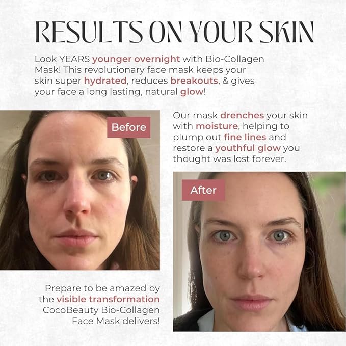 Collagen Sheet Mask – Hydrating Korean Face Mask for Fine Lines & Anti-Aging, Deep Moisture, Radiant Skin Boost, Bio-Collagen Facial Masks (4 Pack)