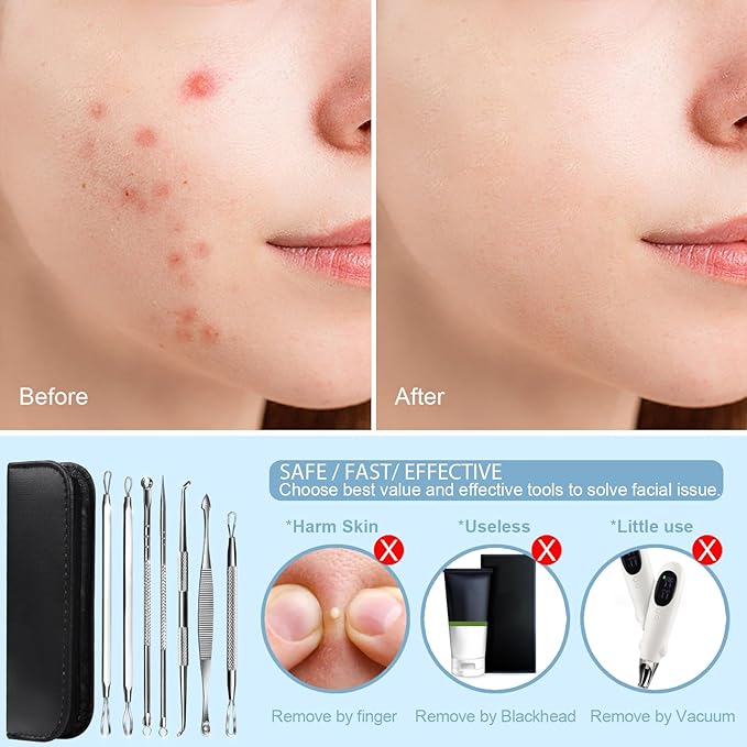 Teenitor 7 in 1 Pimple Popper Tool Kit - Blackhead Remover, Pimple Extractor, Comedone Extractor for Face