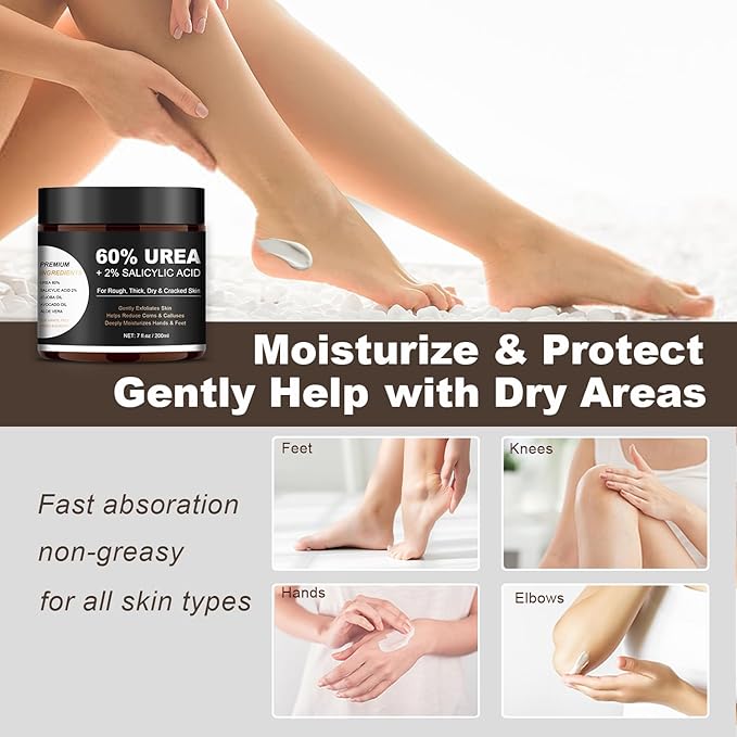 60% Urea Foot & Hand Cream with 2% Salicylic Acid - Intensive Moisturizer for Dry, Cracked Heels, Feet, Elbows, Hands and Knees - Foot Exfoliating Creams with Jojoba Oil, Avocado Oil & Aloe Vera, 7 oz