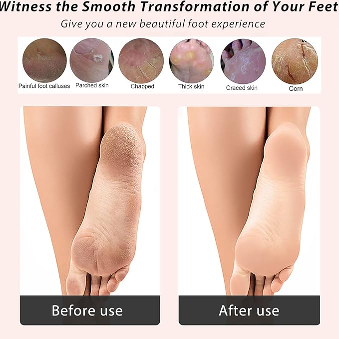 ICDI ICANdOIT Natural Bamboo Foot File Callus Remover-Multi Purpose 4 in 1 Feet Pedicure Kit with Foot Care Boar Bristle Brush,Pumice Stone,Foot Rasp,Sand Paper