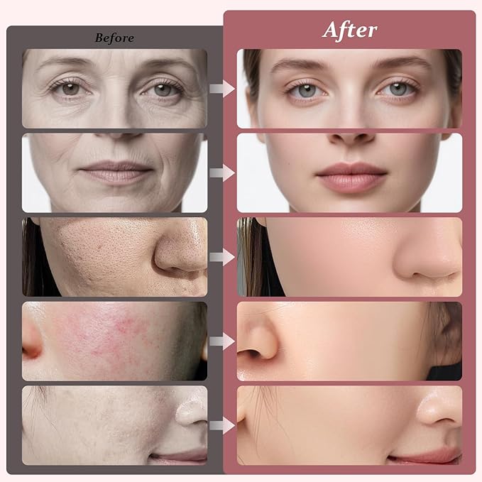 Bio Collagen Real Deep Mask, Bio-Collagen Face Masks - Deep Hydrating Overnight Face Mask, Korean Skincare, 4 PCS Facial Treatments & Masks for Women - Firming & Moisturizing