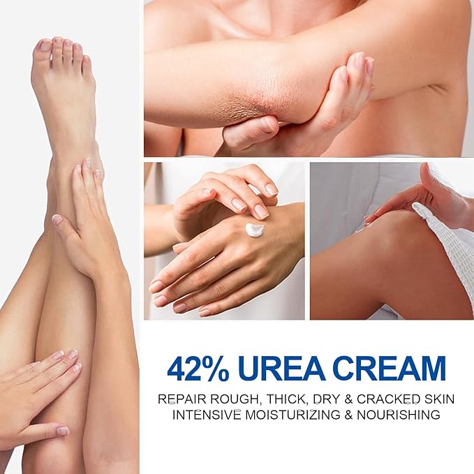 Urea Foot Cream, 42 Percent Urea Cream plus 2% Salicylic Acid Cracked Heel Repair Cream for Feet and Hand Foot Cream for Callus Remover & Nourishes Soften for Hand Foot And Body Care, 100g
