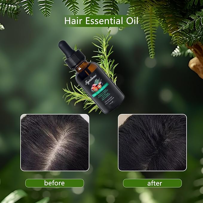 Tgideas Rosemary Batana Oil - Organic Hair Growth -for Scalp & Hair Strengthening - All Hair Types Treatment Oil - Eyebrow & Eyelash Nourishing