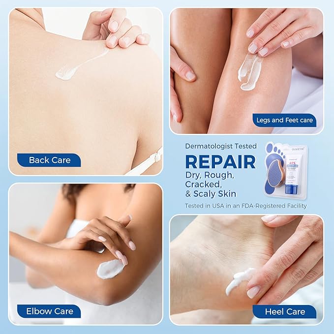 OUKEYA Urea Cream 40 Percent Tube, Urea Cream 40 Percent For Feet Maximum Strength, with Foot Callus Remover, Nano Glass Foot File