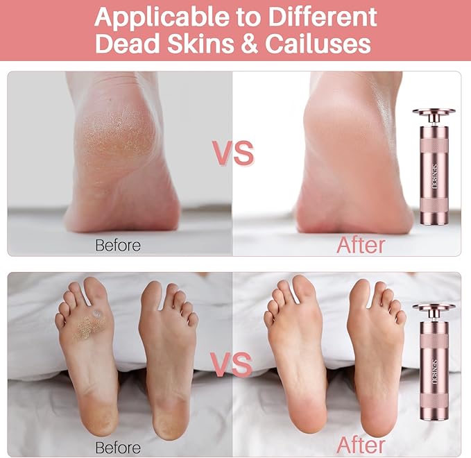 Electric Foot Callus Remover, 2-in-1 Electric Foot Filer/Nail Filer, Callus Remover for Feet with 60Pcs+12Pcs Sandpaper Discs，Holiday Gift Foot Repair Tool, Champagne Gold