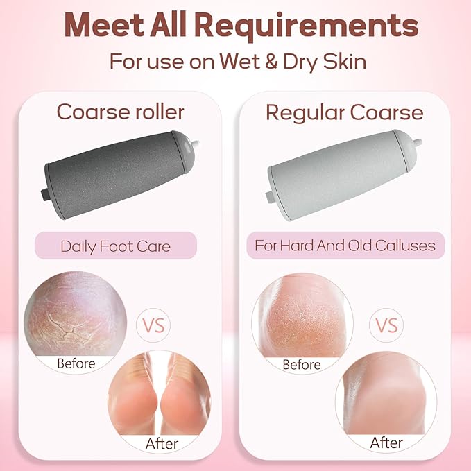 Electric Foot Callus Remover, Callus Remover for Feet Rechargeable Portable Pedicure Tool Kit, Smooth Pedicure Wand for Feet Care, Removes Dry Hard & Dead Skin Ideal Gift (White)