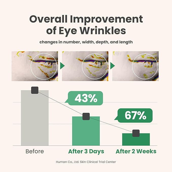 AXIS-Y Vegan Collagen Eye Serum - K Beauty Triple Hyaluronic Acid & Peptide Collagen Serum Improve Skin Elasticity, Reduce Fine Lines & Dark Circles - Vegan Korean Skin Care Eye Cream - 0.33 fl. oz.