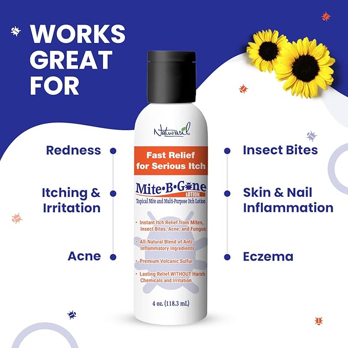 All-Natural Itch Relief by Mite-B-Gone - Sulfur Lotion Treatment for Acne, Bug Bites, Skin Redness & Itching, Discomfort & Rosacea | Safe for Kids and Adults| Fast & Effective for All Skin Types| 4 oz