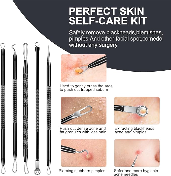 7PCS Blackhead Remover Comedone Extrator Kit, Pimple Extractor Acne Removal Tool Kit, Curved Blackhead Tweezers Kit, Comes with Alcohol Tablets and Magnifying Glasses for Blemish Removal (Iron Box)
