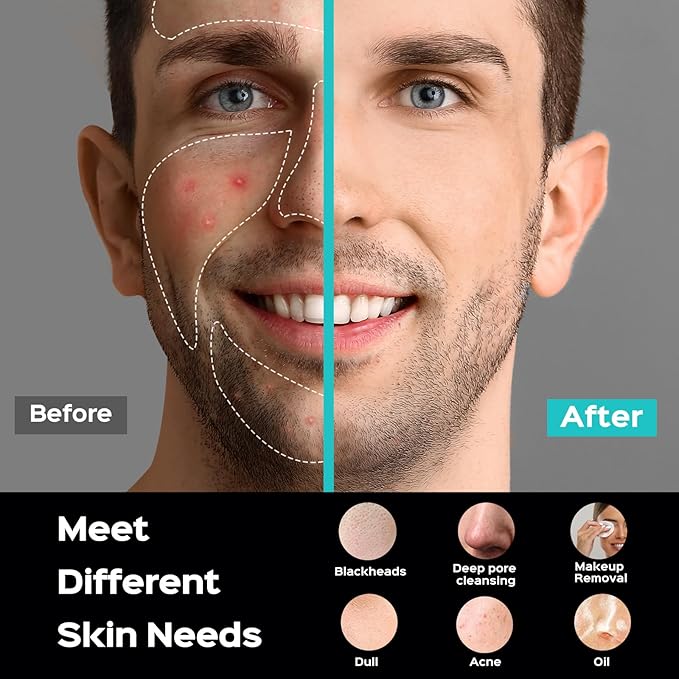 COSLUS Facial Cleansing Brush Face Scrubber: Portable Silicone Waterproof Rechargeable Face Wash Brush, 5 Cleansing Modes, Electric Deep Cleaning for Men & Women, Removing Blackhead, Exfoliating