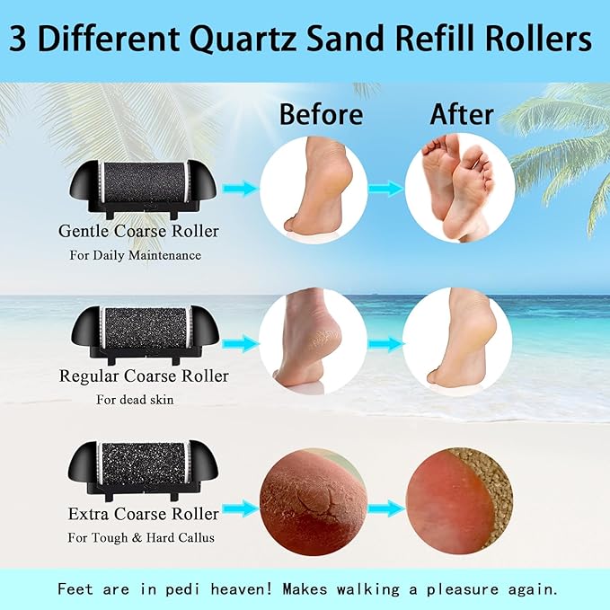 Extra Coarse 3 Refill Rollers for Electric Feet Callus Remover V-601, Replacement Heads Foot Care Pedicure Tools Pack-1 Coarse, 1 Regular and 1 Gentle Rollers (Black)