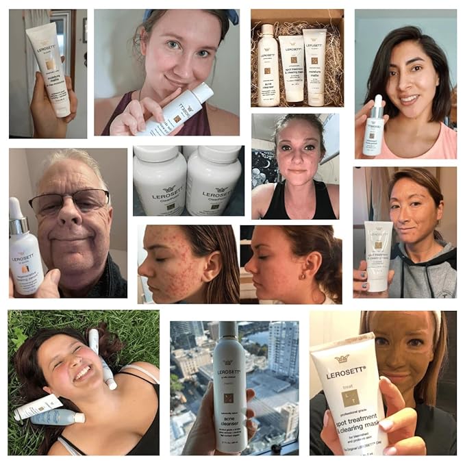 LEROSETT Acne Kit Includes Cleanser Moisturizer & Spot Treatment Mask Organic Calming Aloe & Clay Based, Clears Acne, Pimples, Blackheads & Breakouts, Vegan Acne Kit, For All Skin Types