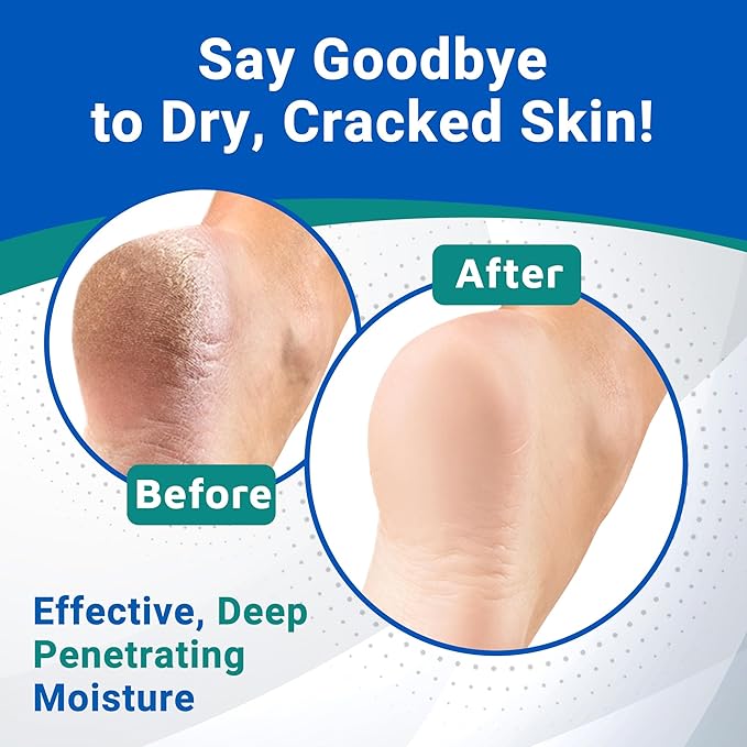 Dermal Therapy Heel Care Liquid Roll-On – Intensive Moisturizing & Repair for Cracked Heels, Dry & Rough Skin – Fast-Absorbing, Mess-Free Application – Hydrating Foot Care Treatment