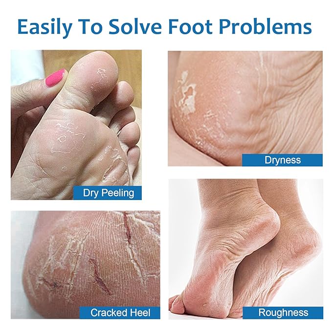 Urea Cream 42 Percent for Feet Maximum Strength - 2Pcs Hydrating Foot Stick Heel Balm for Smooth Skin- Foot Lotion Balm for Dry Rough Cracked Hands Knee Elbow Heel Stick for Women Men - 1.41oz / 40g