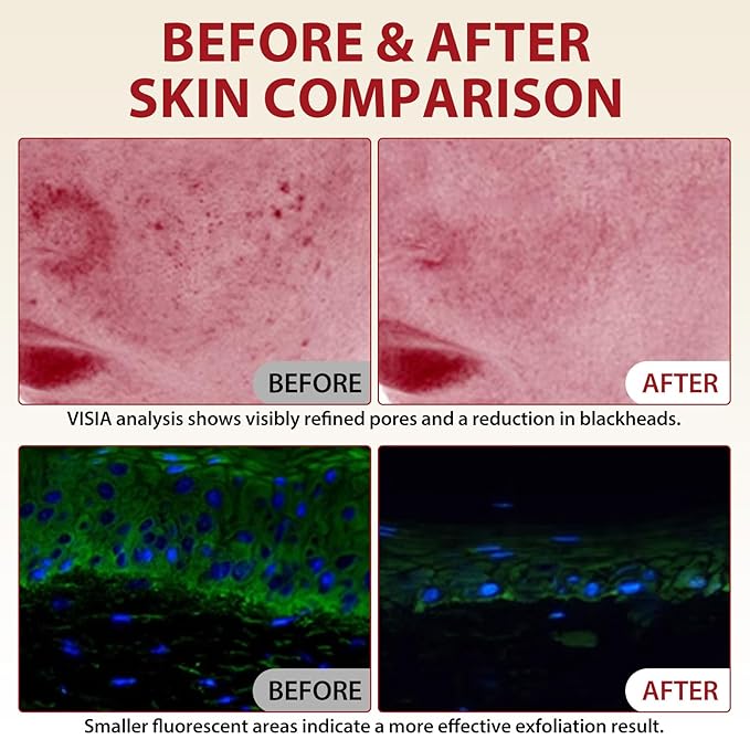 Rice Exfoliating Ampoule Set, Peel Shot Glow Rice Ampoule Duo,Duo for Gentle Peel + Pore Minimizing & Deep Hydration,Body Black and White Rice Exfoliating for All Skin Types 6.76 fl.oz