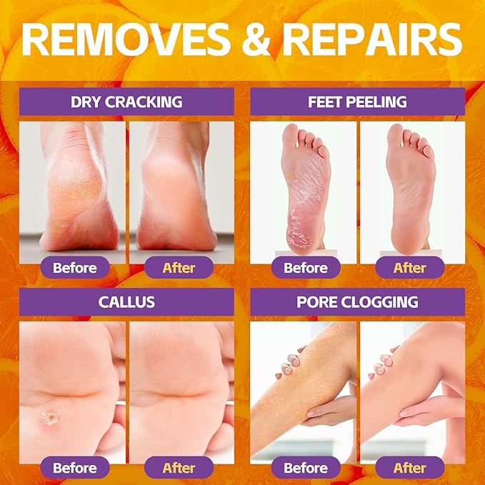 Pedicure Foot Soak, Foot Spa Soak, Pedicure Kit, Bubble Foot Bath for Tired & Dry Cracked Feet, Athletes Feet, Odor Foot and Softens Calluses, Foot Soak 16 Packs A Box, Orange