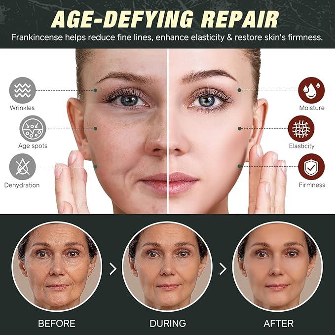 Beef Tallow Balm with Castor Oil & Frankincense – 100% Grass-Fed Beef Tallow Moisturizer for Face & Body Care – Nourishing Skin Balm to Repair Dry Skin, 4.2 oz