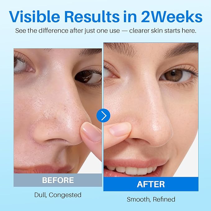 BHA Toner Pads with 0.45% Salicylic Acid – Double-Sided Exfoliating Pads for Pores, Oil Control & Blackheads, Gentle Daily Exfoliation & Wet Compress Mask for Teens, 55 Count