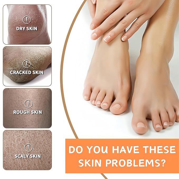 2pcs Cracked Heel Stick Balm, Manuka Honey Heel Stick For Cracked Feet, Foot Cream For Calluses and Dry Feet, Cracked Foot, Manuka Honey Hand Cream