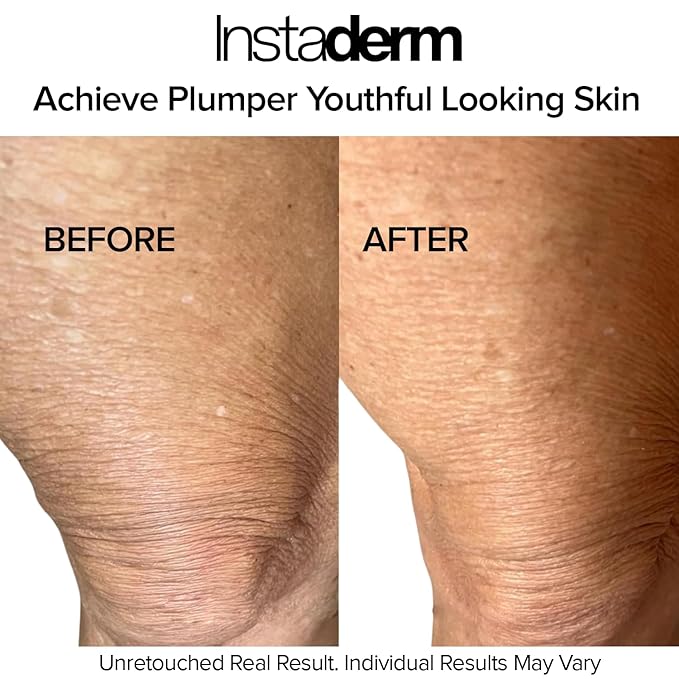 Crepe Fix Body Restorative Cream – Anti-Aging Wrinkle Cream, Support Skins Natural Elastin & Collagen Production to Restore, Lift, Tighten, Hydrate & Smooth Thinning Aged Crepey Skin. 4OZ