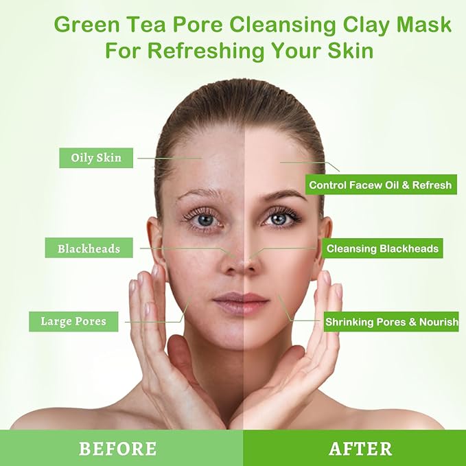 ANAI RUI Green Tea Mask, Clay Mask for Poreless Deep Cleanse, Green Tea Face Mask Blackhead Remover with Kaolin, Aloe, Collagen, Pore Minimizer, Hydrating, Moisturizing