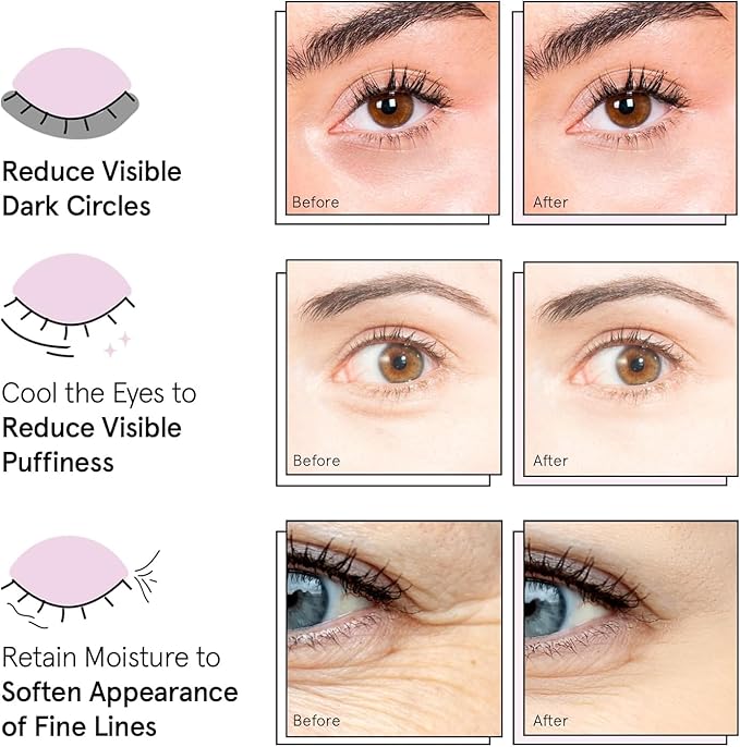 grace & stella Under Eye Mask - Reduce Dark Circles, Puffy Eyes, Undereye Bags, Wrinkles - Gel Under Eye Patches, Vegan Cruelty-Free Self Care (72 Pairs, GoldPinkBlue)