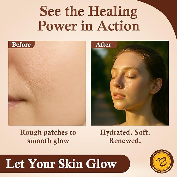 Sweet Bee Magic All In One Healing Organic Balm - Natural Skin Healing Cream, Beeswax Balm for Dry Skin, Face & Body Moisturizer - Certified Organic, All Natural Aid - 2 Jars (2oz Each,4oz Total)